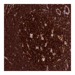 Atlas Antibodies Anti-ADAT1 Antibody