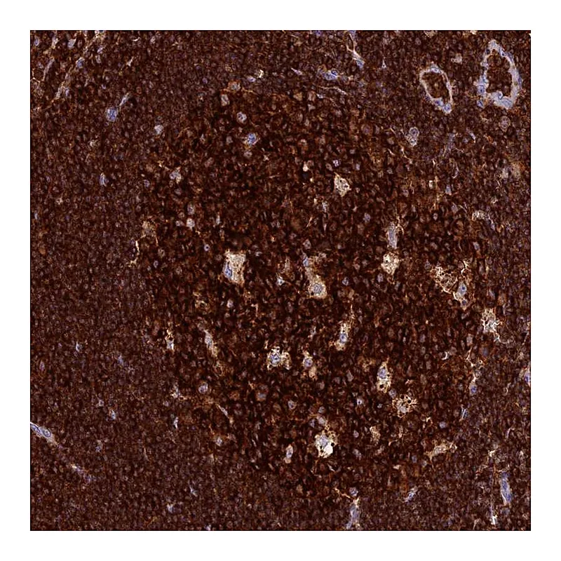 Atlas Antibodies Anti-ADAT1 Antibody