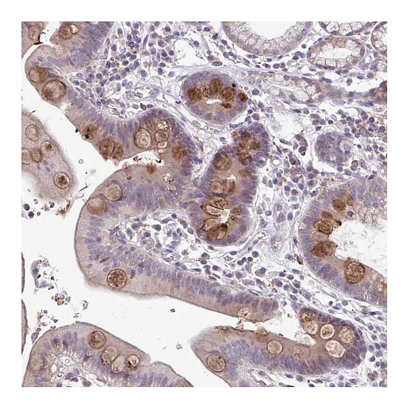 Atlas Antibodies Anti-ADAT3 Antibody