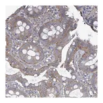 Atlas Antibodies Anti-ADCK1 Antibody