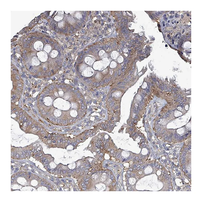 Atlas Antibodies Anti-ADCK1 Antibody