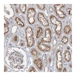 Atlas Antibodies Anti-ADCK2 Antibody