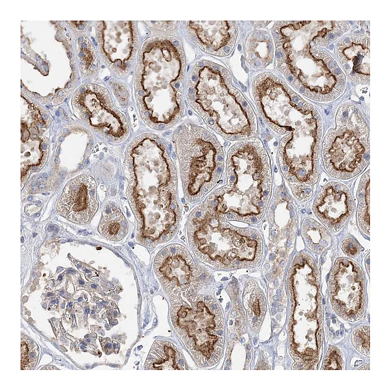 Atlas Antibodies Anti-ADCK2 Antibody