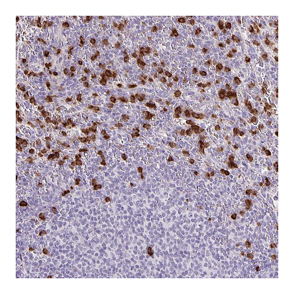 Atlas Antibodies Anti-ADCK1 Antibody