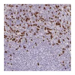 Atlas Antibodies Anti-ADCK1 Antibody