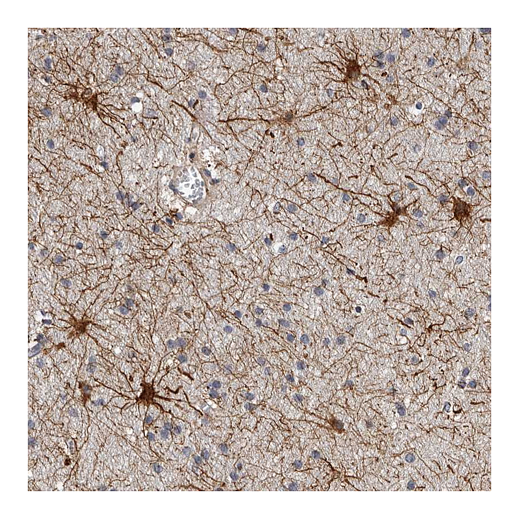 Atlas Antibodies Anti-ADCK5 Antibody