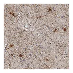 Atlas Antibodies Anti-ADCK5 Antibody