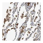 Atlas Antibodies Anti-ADCY10 Antibody