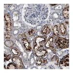 Atlas Antibodies Anti-ADCY10 Antibody