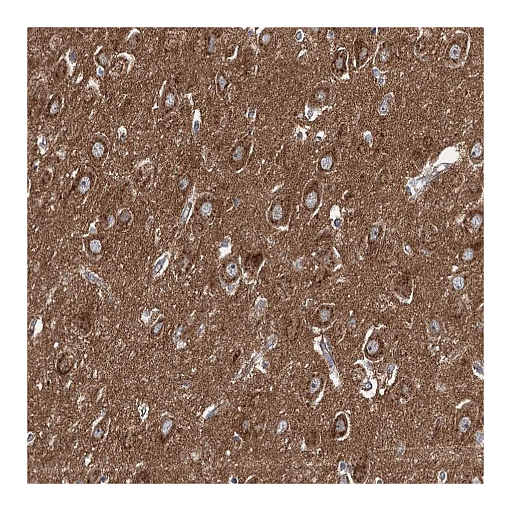 Atlas Antibodies Anti-ADCY2 Antibody