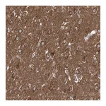 Atlas Antibodies Anti-ADCY2 Antibody