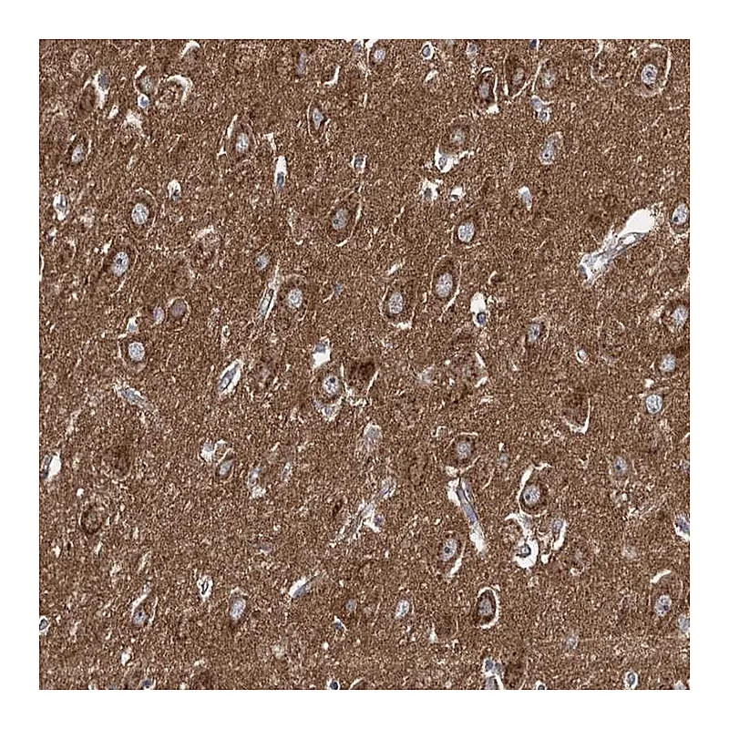 Atlas Antibodies Anti-ADCY2 Antibody