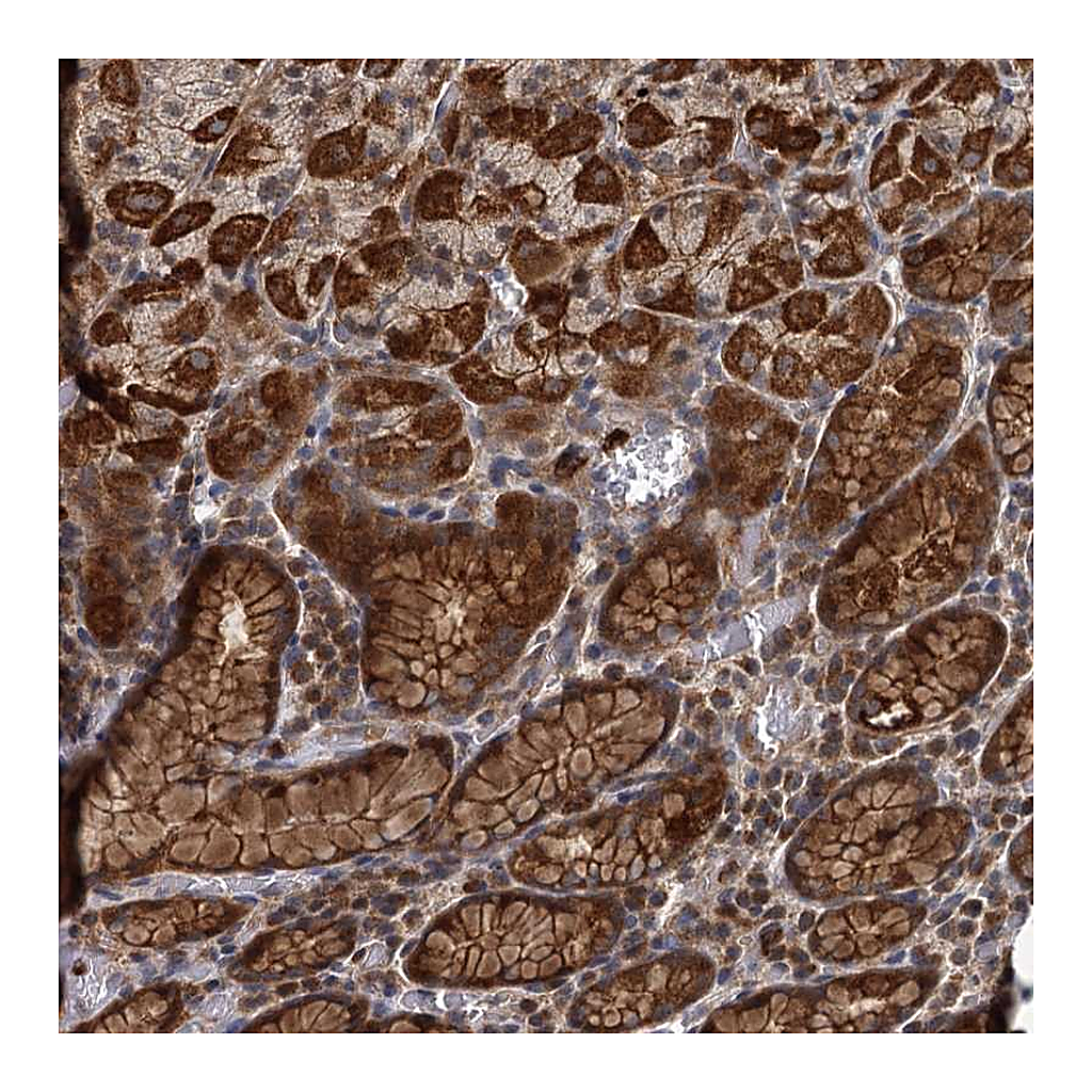 Atlas Antibodies Anti-ADCY2 Antibody