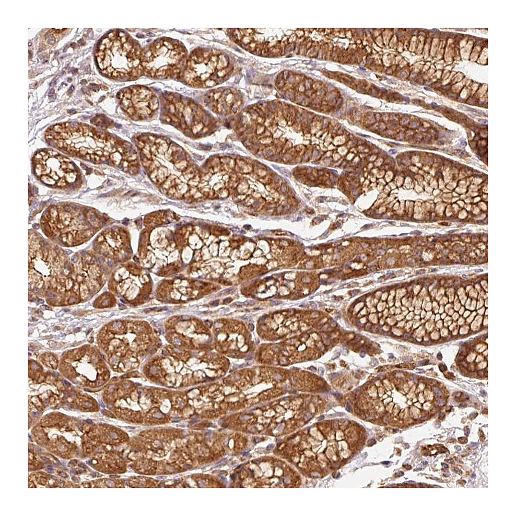 Atlas Antibodies Anti-ADCY4 Antibody