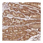 Atlas Antibodies Anti-ADCY4 Antibody