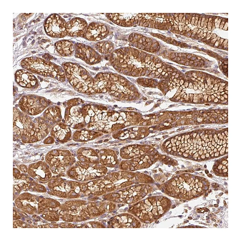 Atlas Antibodies Anti-ADCY4 Antibody