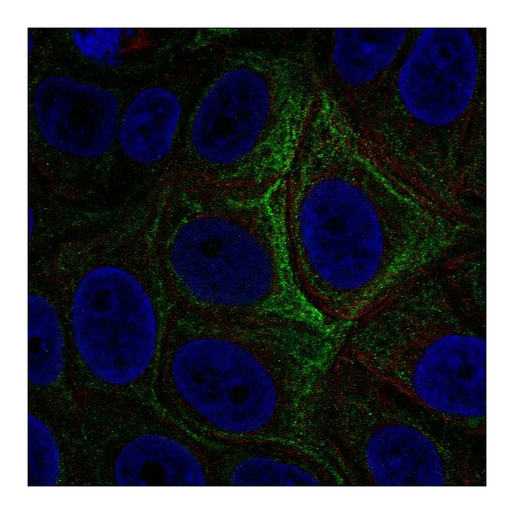 Atlas Antibodies Anti-ADCY5 Antibody
