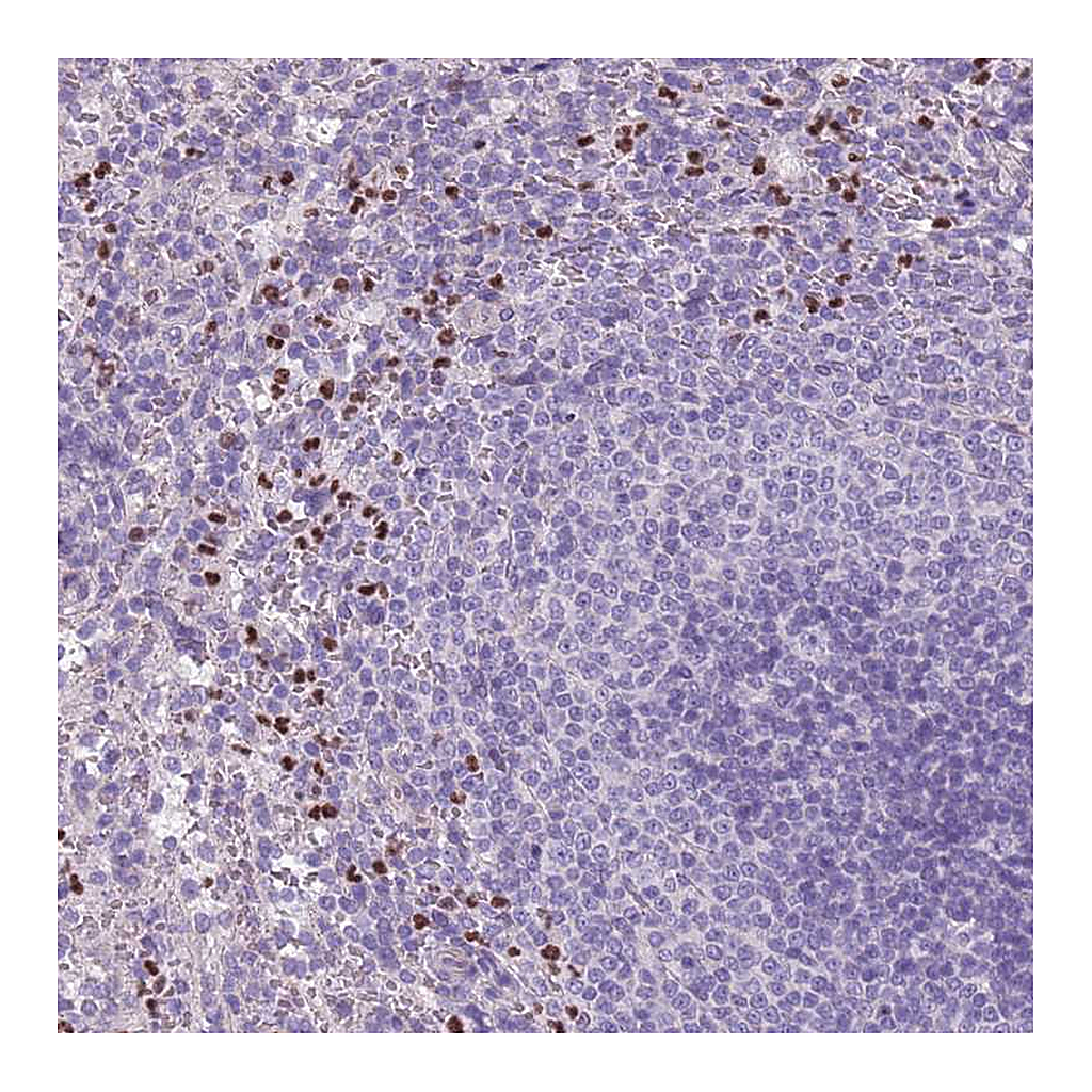 Atlas Antibodies Anti-ADCY7 Antibody