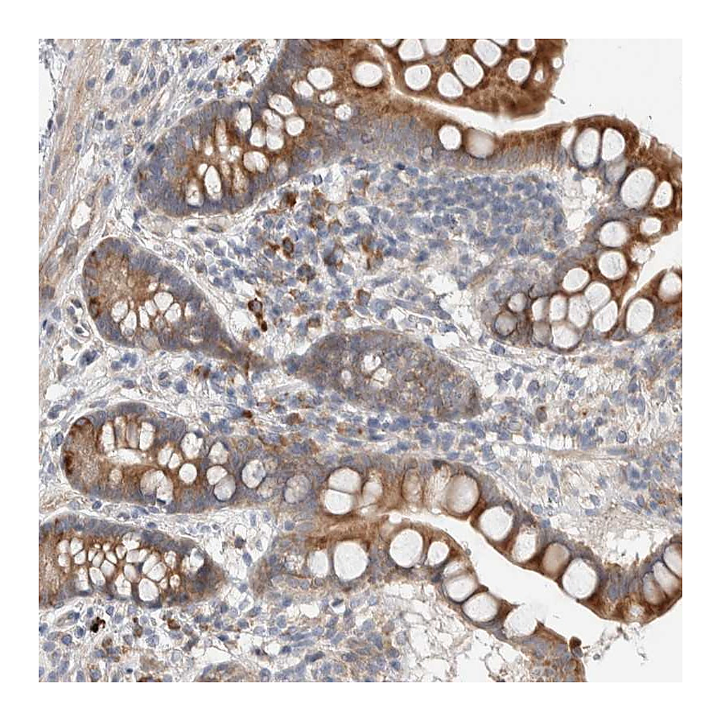 Atlas Antibodies Anti-ADCY8 Antibody