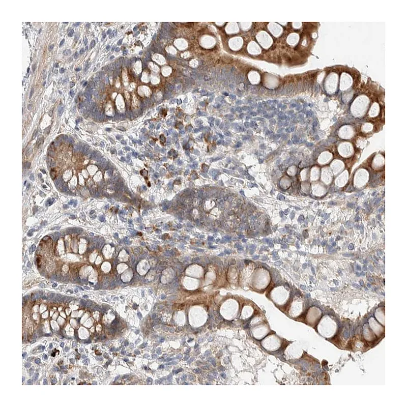 Atlas Antibodies Anti-ADCY8 Antibody