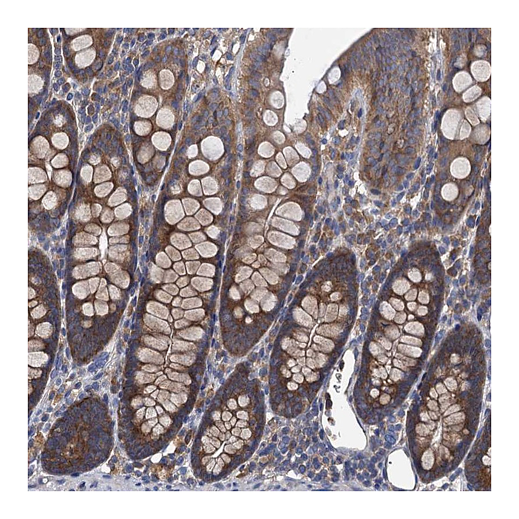Atlas Antibodies Anti-ADCY9 Antibody