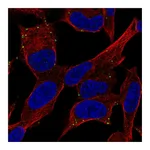 Atlas Antibodies Anti-ADCYAP1R1 Antibody