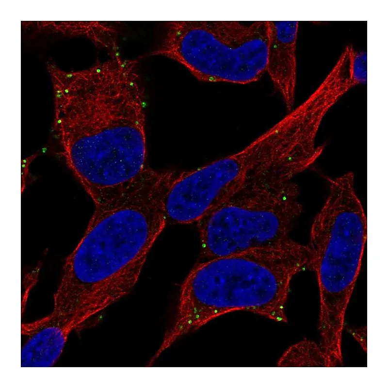 Atlas Antibodies Anti-ADCYAP1R1 Antibody