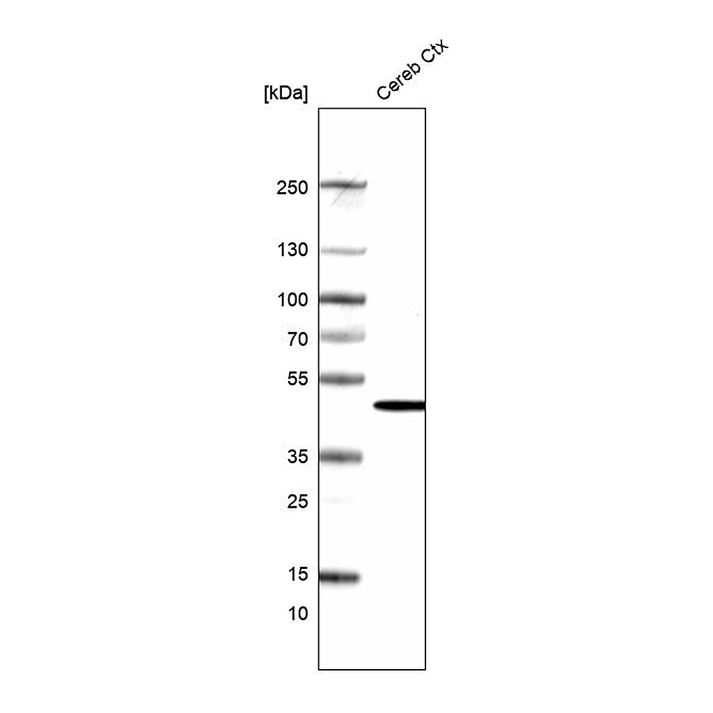 Atlas Antibodies Anti-ADCYAP1R1 Antibody
