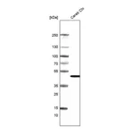 Atlas Antibodies Anti-ADCYAP1R1 Antibody