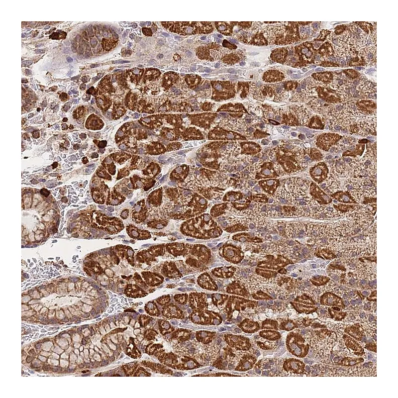 Atlas Antibodies Anti-ADCY9 Antibody