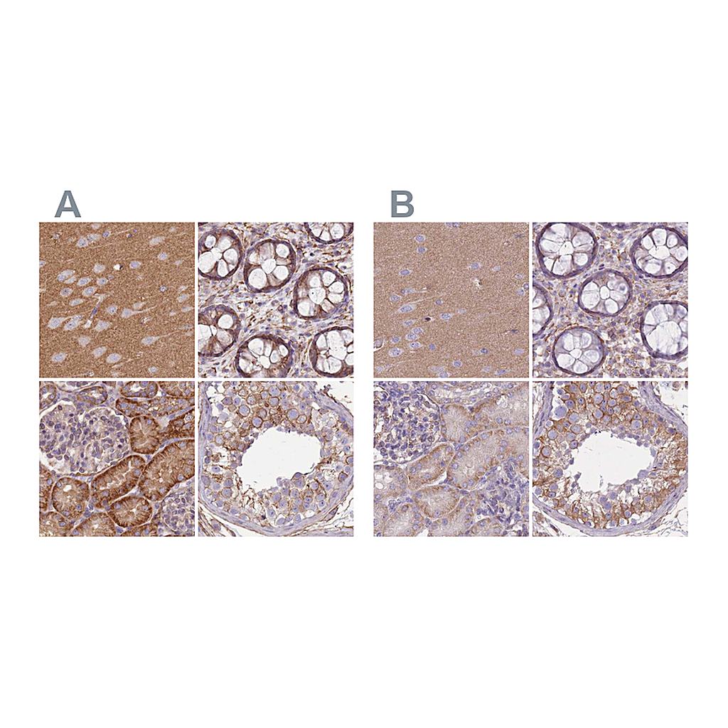 Atlas Antibodies Anti-ADD1 Antibody