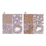 Atlas Antibodies Anti-ADD1 Antibody