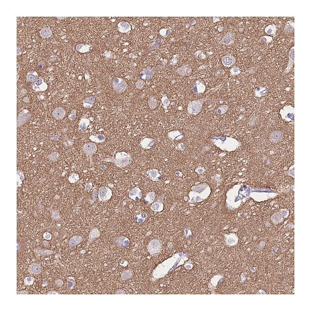 Atlas Antibodies Anti-ADD2 Antibody