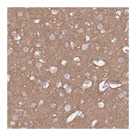 Atlas Antibodies Anti-ADD2 Antibody
