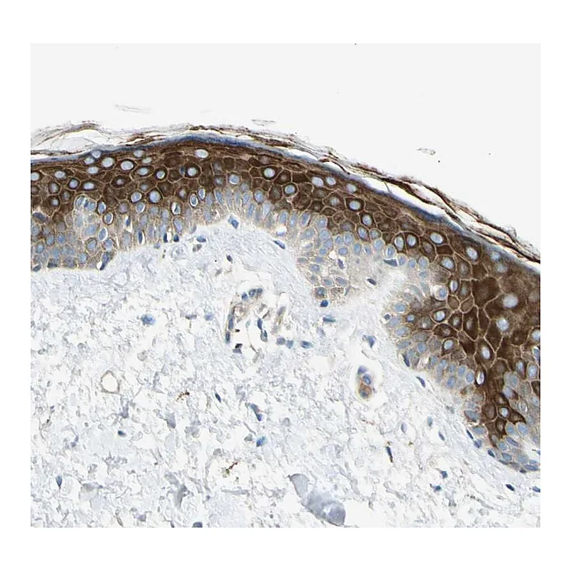Atlas Antibodies Anti-ADGRA3 Antibody