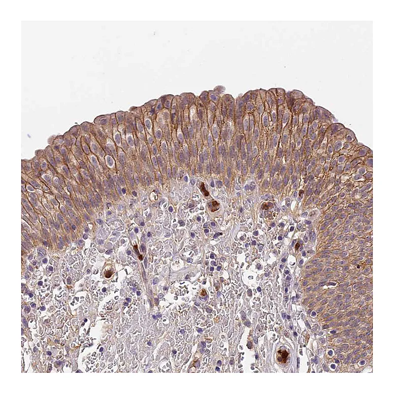 Atlas Antibodies Anti-ADGRD1 Antibody