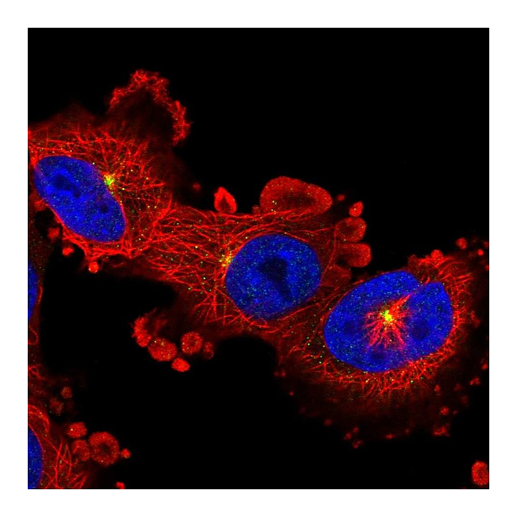 Atlas Antibodies Anti-ADGRB2 Antibody