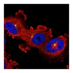 Atlas Antibodies Anti-ADGRB2 Antibody