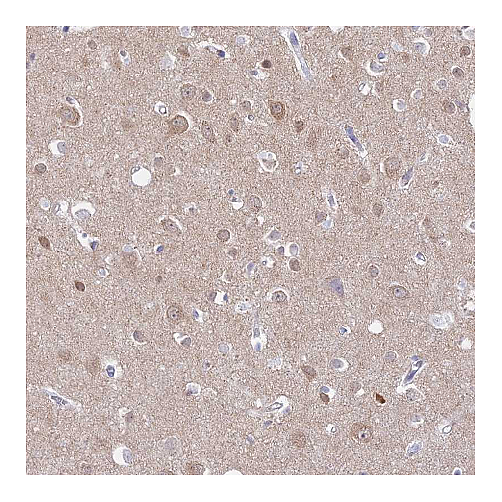 Atlas Antibodies Anti-ADGRA1 Antibody