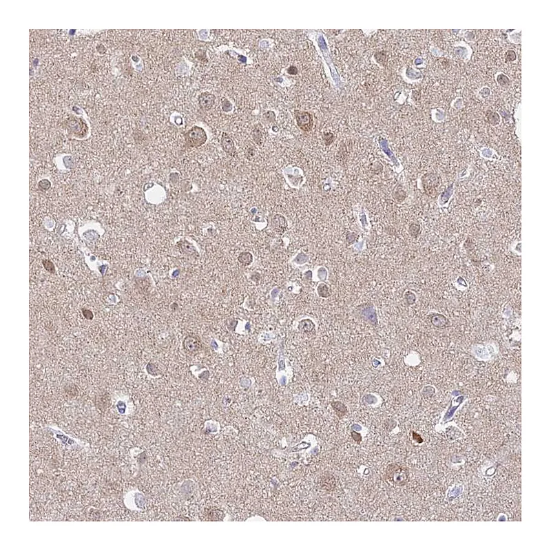 Atlas Antibodies Anti-ADGRA1 Antibody