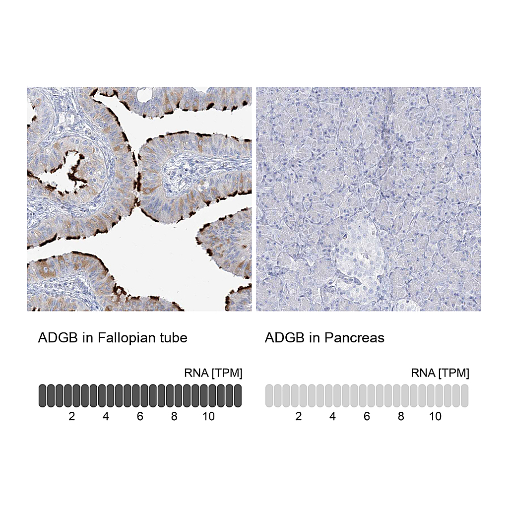 Atlas Antibodies Anti-ADGB Antibody