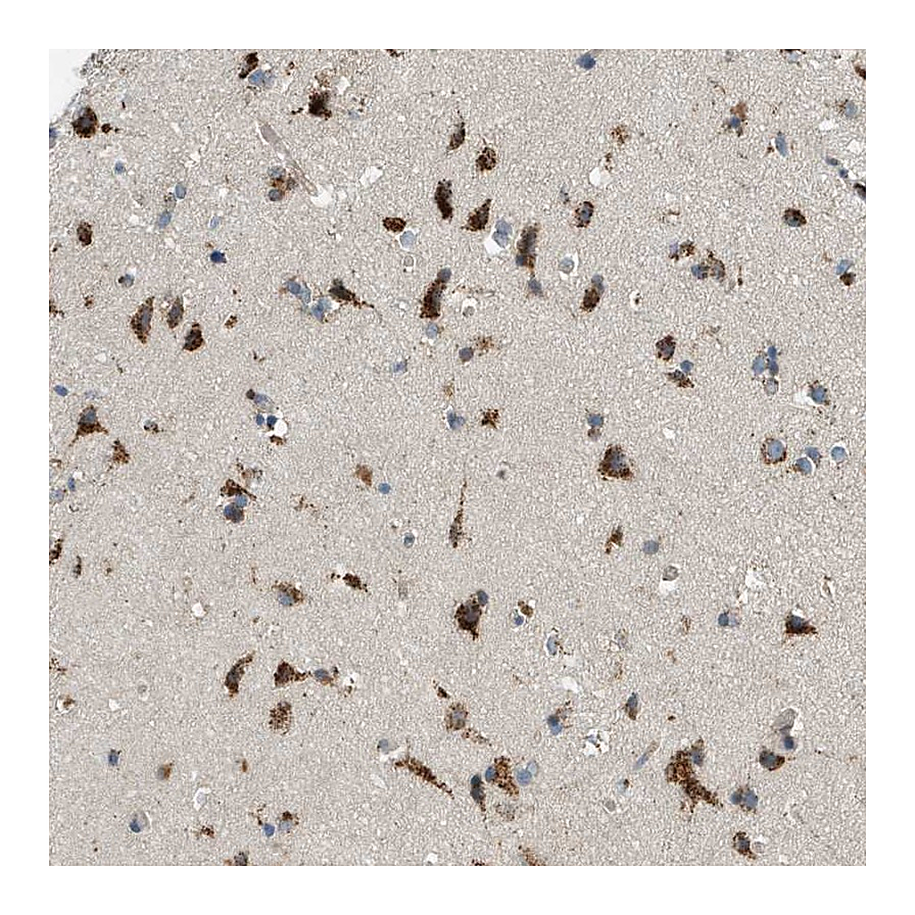 Atlas Antibodies Anti-ADGRF2 Antibody