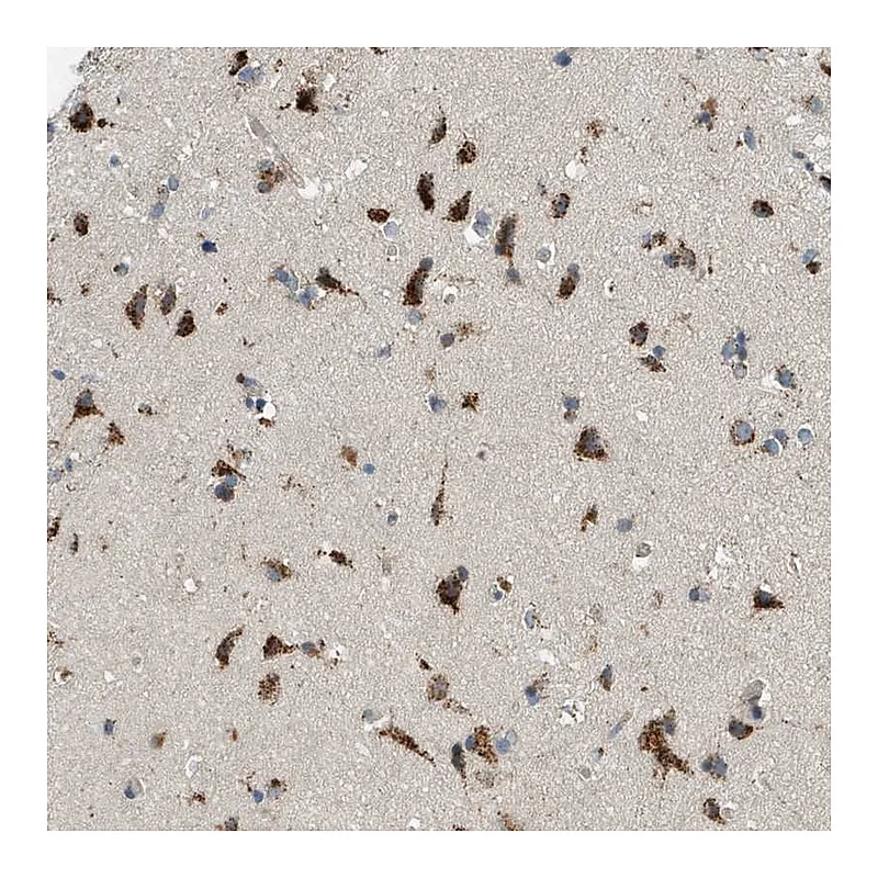 Atlas Antibodies Anti-ADGRF2 Antibody