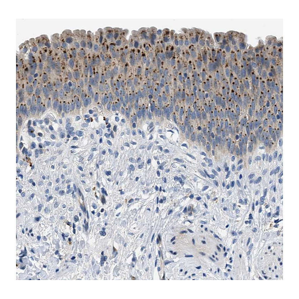 Atlas Antibodies Anti-ADGRE3 Antibody