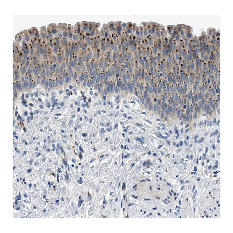 Atlas Antibodies Anti-ADGRE3 Antibody
