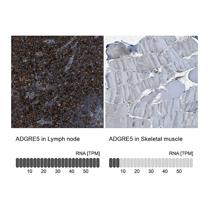 Atlas Antibodies Anti-ADGRE5 Antibody