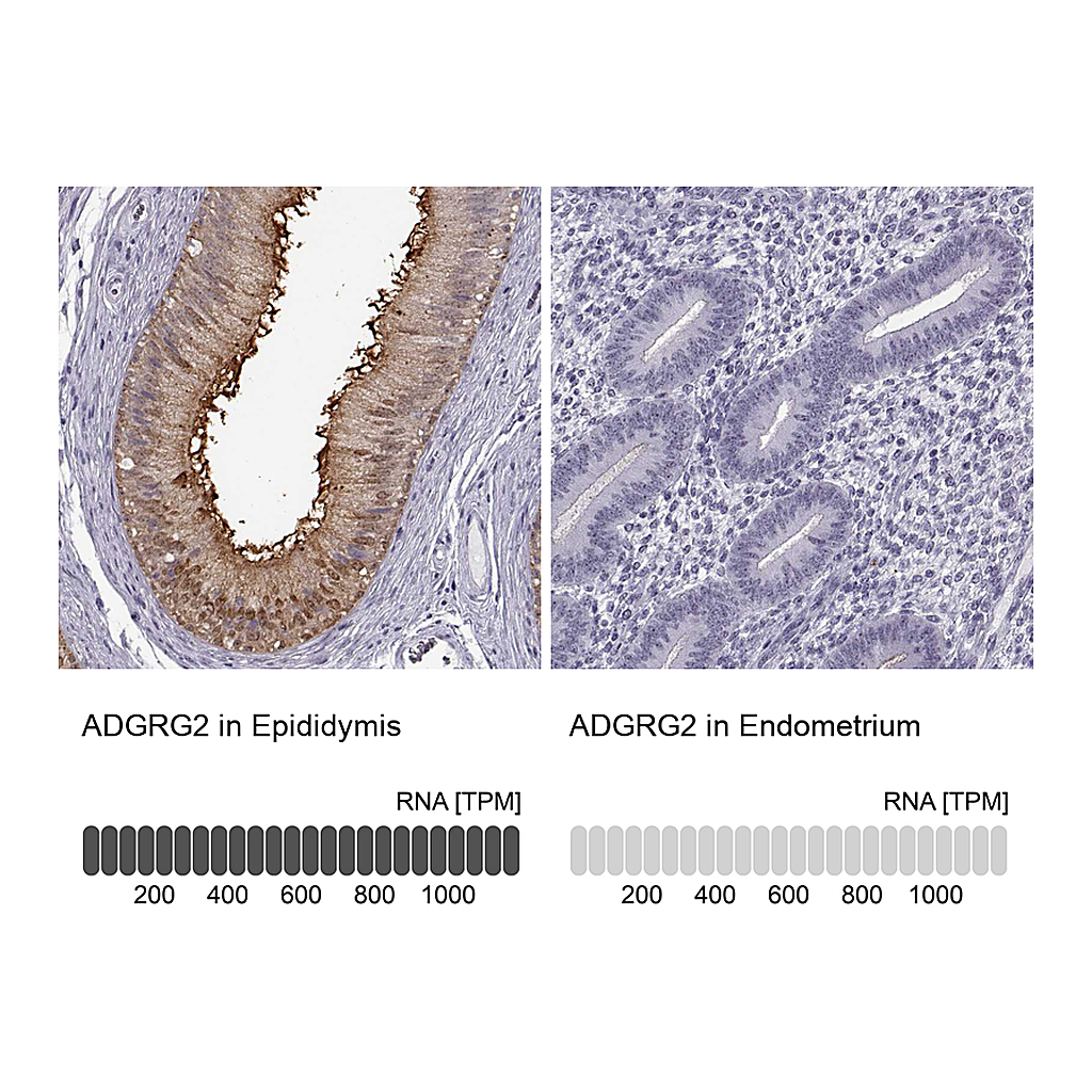 Atlas Antibodies Anti-ADGRG2 Antibody