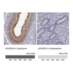 Atlas Antibodies Anti-ADGRG2 Antibody