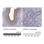 Atlas Antibodies Anti-ADGRG2 Antibody