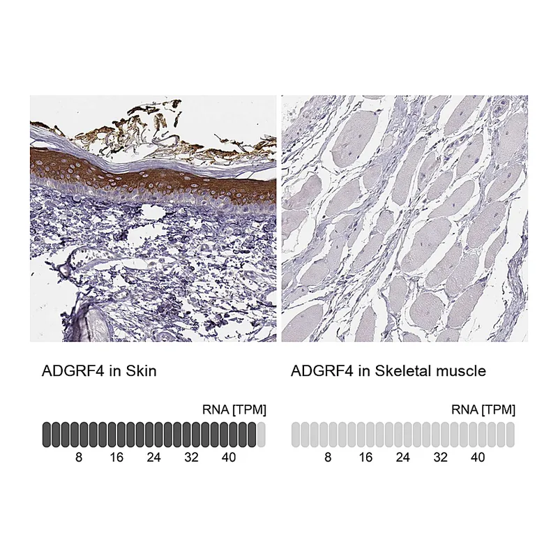 Atlas Antibodies Anti-ADGRF4 Antibody